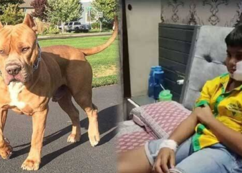 Crime పార్క్‌లో ఆడుకుంటున్న బాలుడిపై పెంపుడు కుక్క దాడి… చిన్నారి మొహంపై ఏకంగా 200 కుట్లు