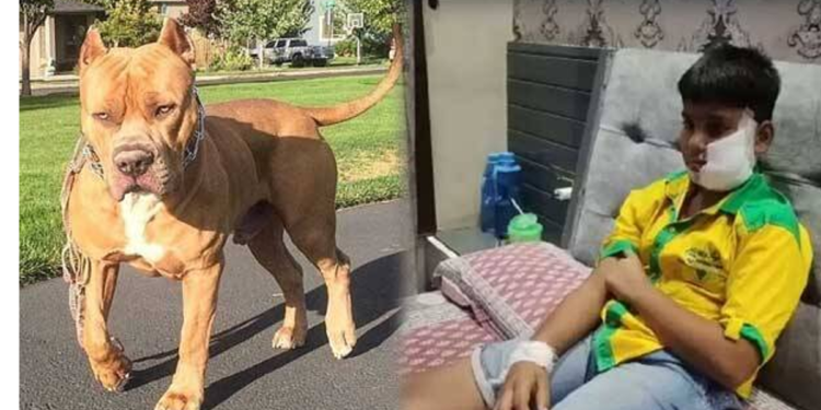 Crime పార్క్లో ఆడుకుంటున్న బాలుడిపై పెంపుడు కుక్క దాడి… చిన్నారి మొహంపై ఏకంగా 200 కుట్లు