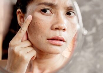 Health వృద్ధాప్య లక్షణాలకు ఈ ఆహారాలే కారణం..