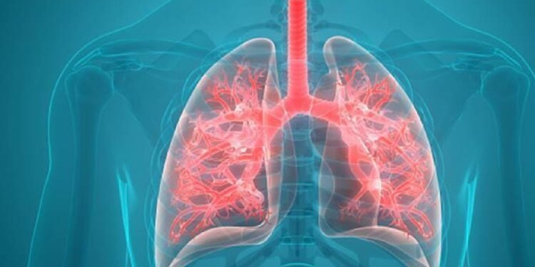 Health ఈ లక్షణాలు ఉన్నాయా అయితే ఊపిరితిత్తులలో నీరు చేరినట్టే..